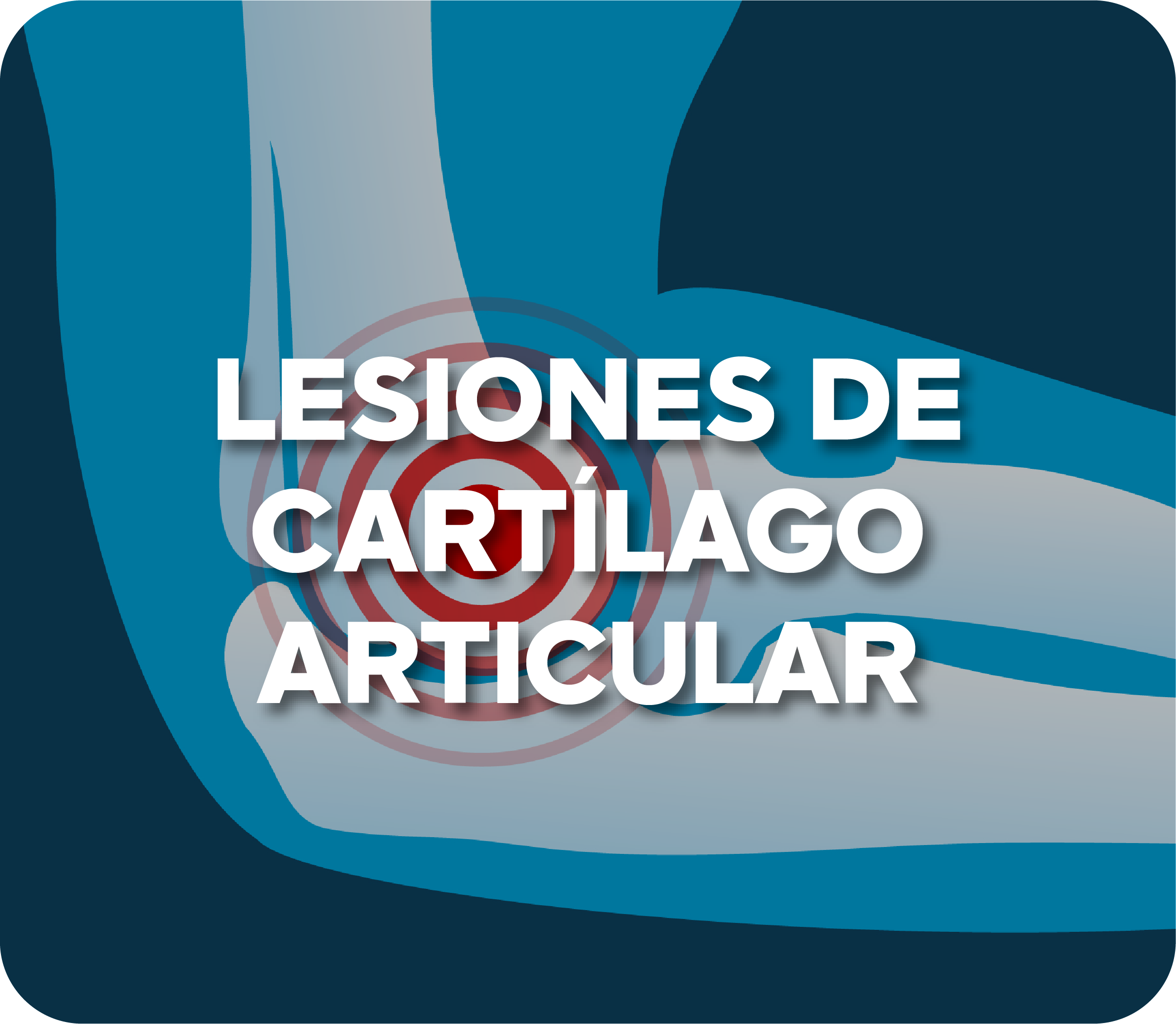 Luxación de hombro